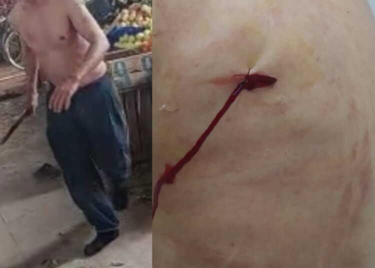  شخص يطعن قائدا من الخلف .. بسبب تحرير الملك العمومي