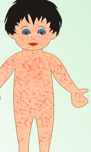 بو … حم… رون