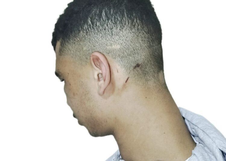 اعتقال شاب بتيفلت يثير الجدل ومركز حقوقي يطالب بفتح تحقيق في مزاعم اعتداء وإهمال طبي