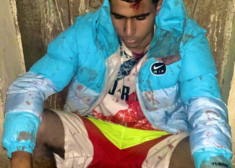 “مركز عدالة” يدعو إلى احترام مبدأ المساواة أمام القانون في قضية ضرب وجروح