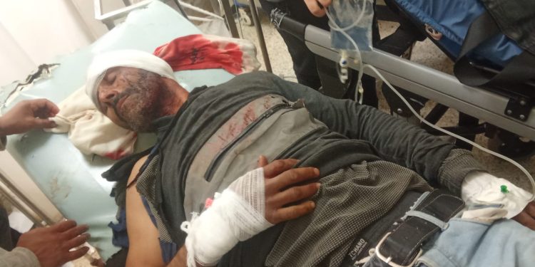 اعتداء خطير يهزّ سيدي عبد الرزاق… والإفراج عن المتهمين يثير الجدل