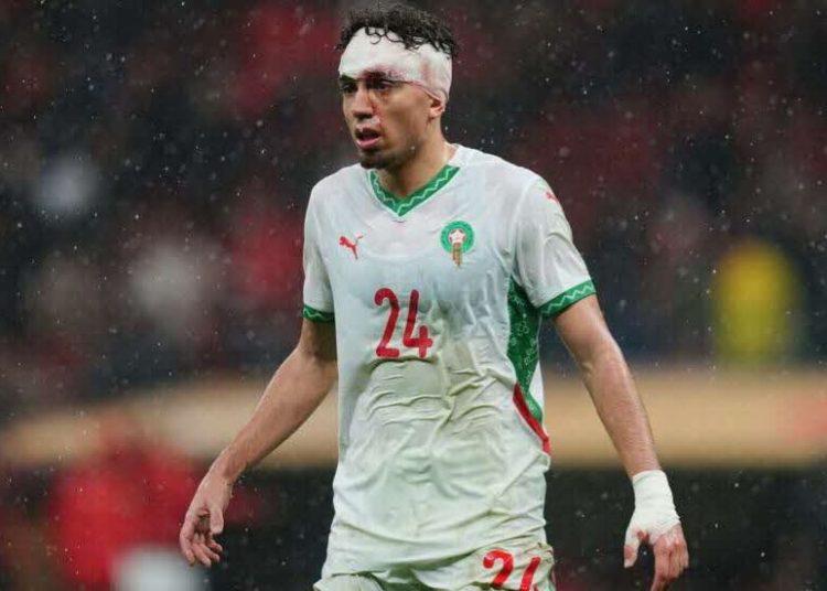 الهجمات الإعلامية والقضائية الفرنسية ضد معسكر أسود الأطلس.. توقيت مريب يستهدف التشتيت الذهني