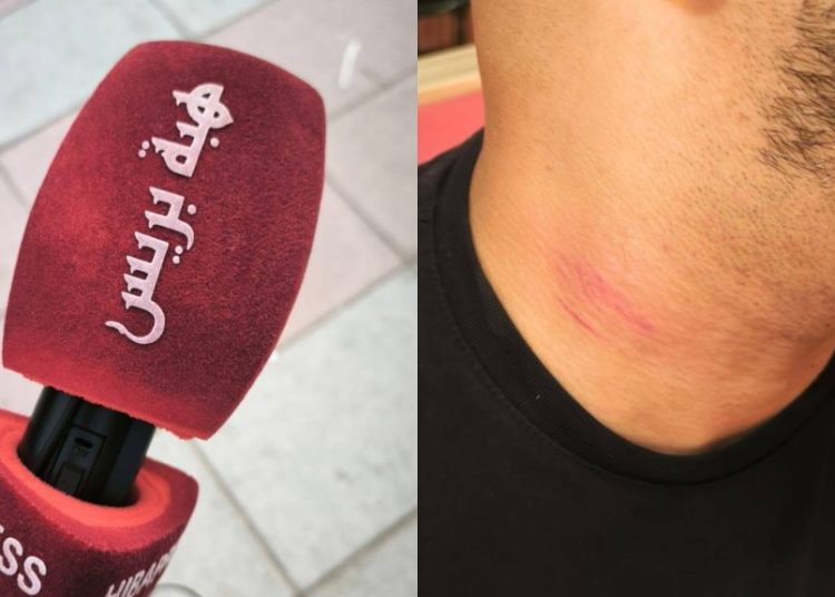 الشرطة الإسبانية تعتدي على مراسل “هبة بريس” أثناء تغطيته لأوضاع المهاجرين بسبتة