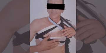 مركز عدالة يندد بتماطل الأمن في تيفلت إزاء اعتداء موثق بشهادة 40 يوماً