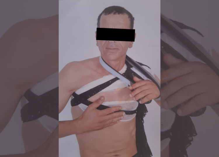 مركز عدالة يندد بتماطل الأمن في تيفلت إزاء اعتداء موثق بشهادة 40 يوماً
