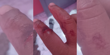 مركز عدالة يطالب بعلاج نفسي عاجل لمواطن بدل السجن بتيفلت