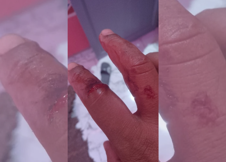 مركز عدالة يطالب بعلاج نفسي عاجل لمواطن بدل السجن بتيفلت